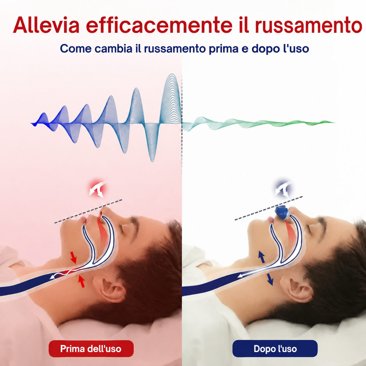 Micro CPAP Portatile Anti-Russamento Apnea del Sonno